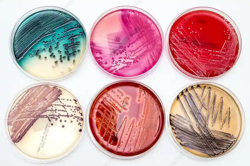 Agar Agar Prices, Trends & Forecasts: An In-Depth Analysis