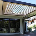 Unlocking Smiles: The Journey from Wisdom Tooth Removal to Porcelain Veneers