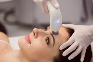 Laser Skin Removal for Sensitive Skin