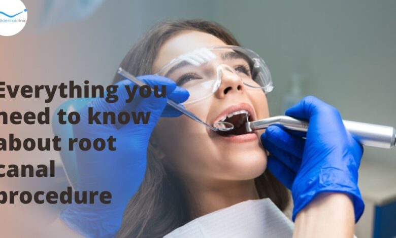 root-canal-treatment