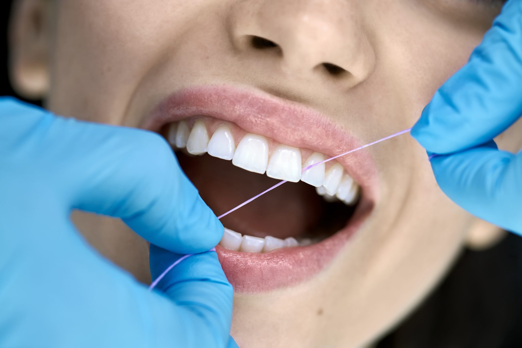 Secrets to a Brighter Smile: Why Regular Dental Cleanings Matter