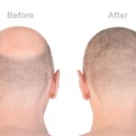 The Ultimate Guide to Demat Accounts: How to Get One for Free and Start Investing Today